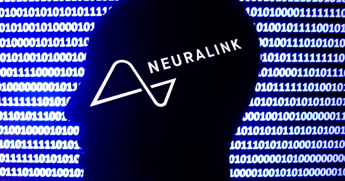 Watch Live: Neuralink Brain Implant ‘Show and Tell’ Update